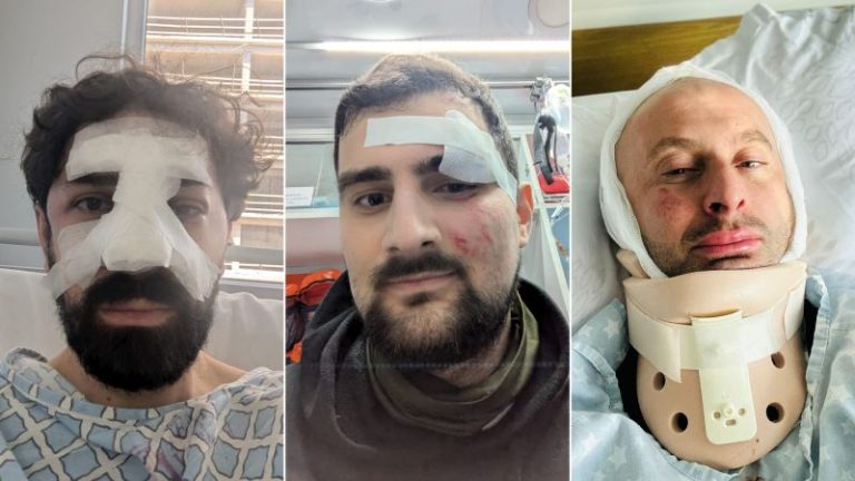 Georgian protesters detail brutal beatings by special forces